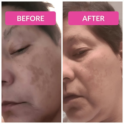 Super C Serum